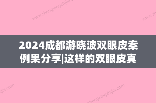 2024成都游晓波双眼皮案例果分享|这样的双眼皮真的绝了~(四川省人民医院游晓波双眼皮)