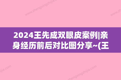 2024王先成双眼皮案例|亲身经历前后对比图分享~(王梓双眼皮案例)