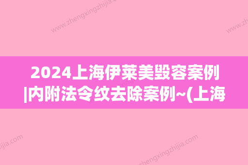 2024上海伊莱美毁容案例|内附法令纹去除案例~(上海伊莱美毁容毁)