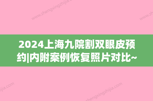 2024上海九院割双眼皮预约|内附案例恢复照片对比~(上海九院割双眼皮要提前多久预约)