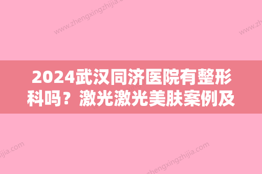 2024武汉同济医院有整形科吗？激光激光美肤案例及果图展示