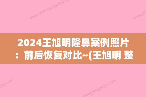 2024王旭明隆鼻案例照片：前后恢复对比~(王旭明 整形)