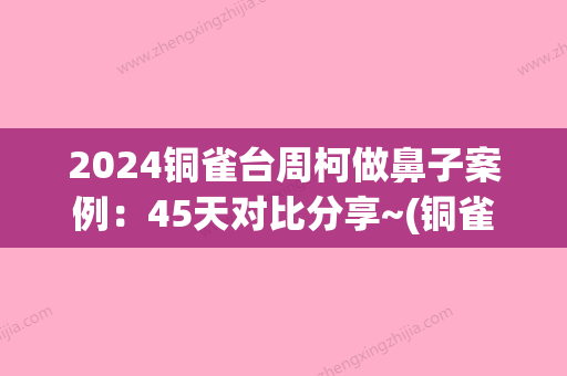 2024铜雀台周柯做鼻子案例：45天对比分享~(铜雀台周柯做的鼻子怎么样)