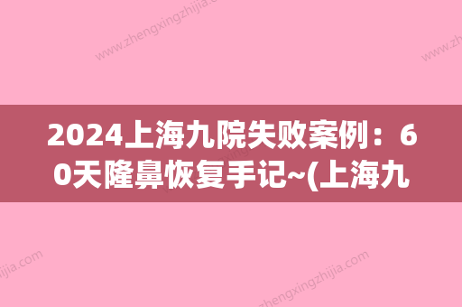 2024上海九院失败案例：60天隆鼻恢复手记~(上海九院假体隆鼻)