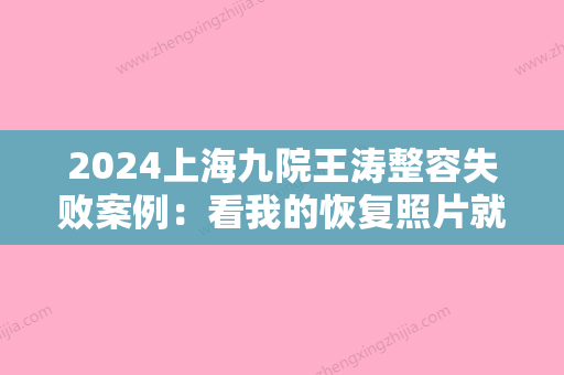 2024上海九院王涛整容失败案例：看我的恢复照片就知道呢~