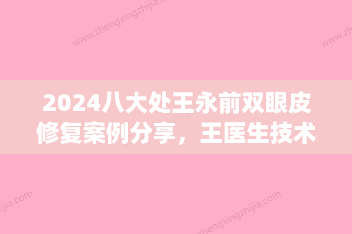 2024八大处王永前双眼皮修复案例分享，王医生技术真的很不错~(八大处马宁修复双眼皮)