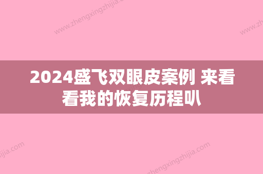 2024盛飞双眼皮案例 来看看我的恢复历程叭