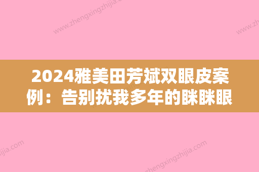 2024雅美田芳斌双眼皮案例：告别扰我多年的眯眯眼~