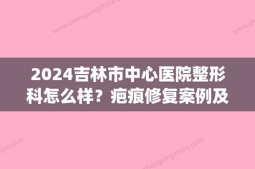 2024吉林市中心医院整形科怎么样？疤痕修复案例及果图一览(吉林市去疤痕整容比较好的医院)