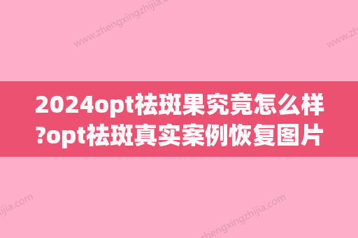 2024opt祛斑果究竟怎么样?opt祛斑真实案例恢复图片分享~