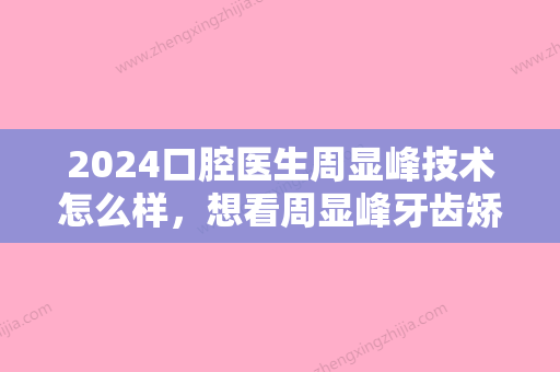 2024口腔医生周显峰技术怎么样，想看周显峰牙齿矫正的案例呢~