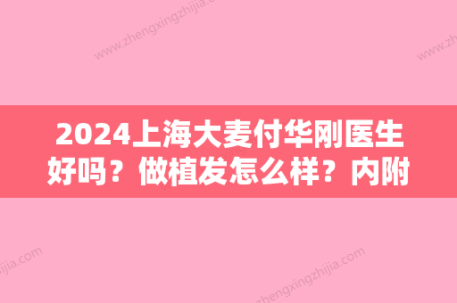 2024上海大麦付华刚医生好吗？做植发怎么样？内附案例