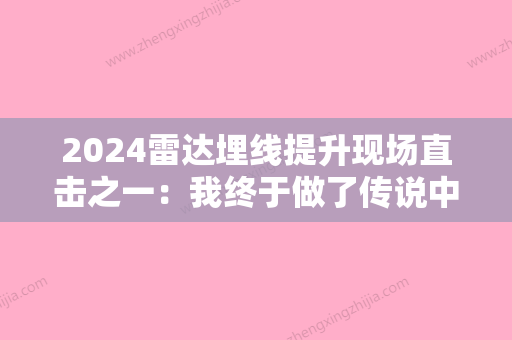 2024雷达埋线提升现场直击之一：我终于做了传说中的雷达埋线提升~