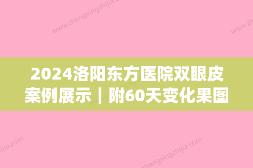 2024洛阳东方医院双眼皮案例展示｜附60天变化果图(洛阳中心医院割双眼皮)