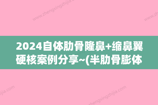 2024自体肋骨隆鼻+缩鼻翼硬核案例分享~(半肋骨膨体隆鼻后遗症)