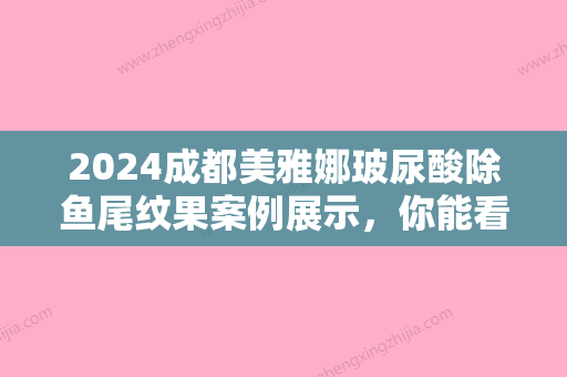 2024成都美雅娜玻尿酸除鱼尾纹果案例展示，你能看出这是40岁的脸?