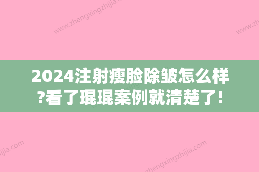 2024注射瘦脸除皱怎么样?看了琨琨案例就清楚了!