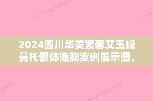 2024四川华美紫馨艾玉峰曼托假体隆胸案例展示图，果好不好自己定夺