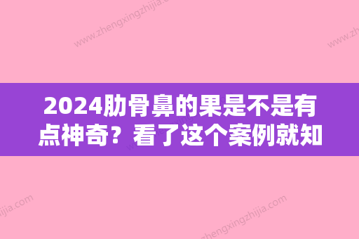 2024肋骨鼻的果是不是有点神奇？看了这个案例就知道了！