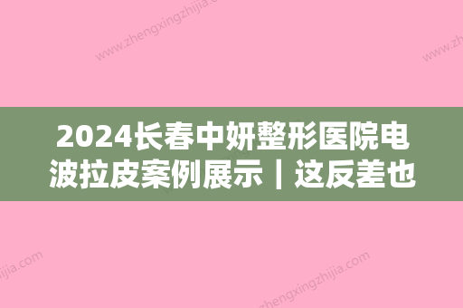 2024长春中妍整形医院电波拉皮案例展示｜这反差也太大了吧