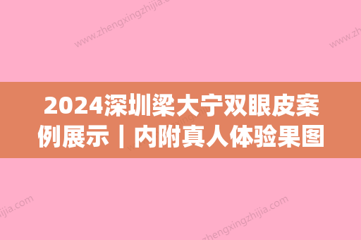 2024深圳梁大宁双眼皮案例展示｜内附真人体验果图(深圳梁志为双眼皮)