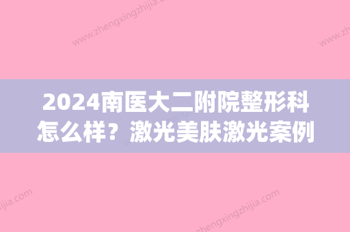 2024南医大二附院整形科怎么样？激光美肤激光案例及果图一览(南京医科大学第二附属医院美容整形)