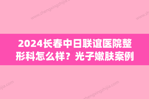 2024长春中日联谊医院整形科怎么样？光子嫩肤案例+价格表一览(长春中日联谊医院整形美容科)