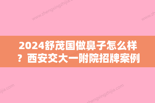 2024舒茂国做鼻子怎么样？西安交大一附院招牌案例公布