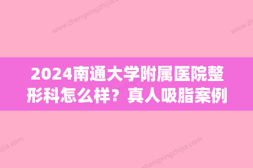 2024南通大学附属医院整形科怎么样？真人吸脂案例分享(南通吸脂哪个医生好)