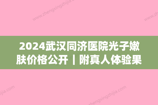 2024武汉同济医院光子嫩肤价格公开｜附真人体验果图(武汉同济光子嫩肤多少钱一次)