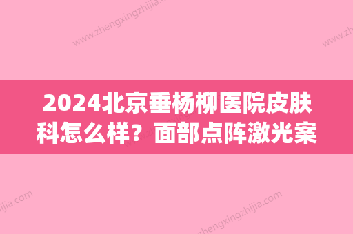 2024北京垂杨柳医院皮肤科怎么样？面部点阵激光案例+果图分享(北京市垂杨柳医院 皮肤科在哪个院区)