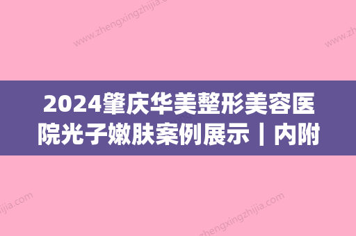 2024肇庆华美整形美容医院光子嫩肤案例展示｜内附前后对比图(肇庆华美整形美容医院官网)