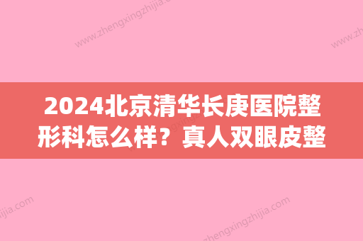 2024北京清华长庚医院整形科怎么样？真人双眼皮整形案例公开(清华大学长庚医院整形外科)