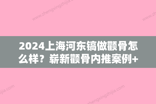 2024上海河东镐做颧骨怎么样？崭新颧骨内推案例+果图公开