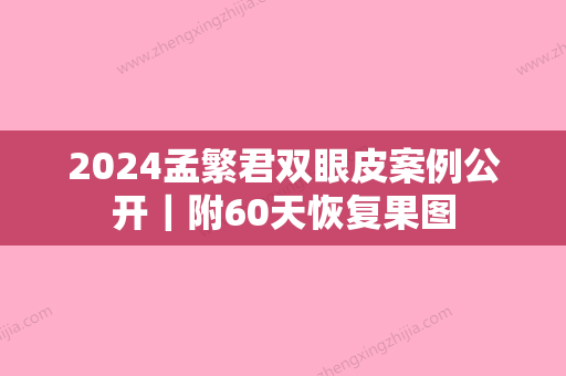 2024孟繁君双眼皮案例公开｜附60天恢复果图