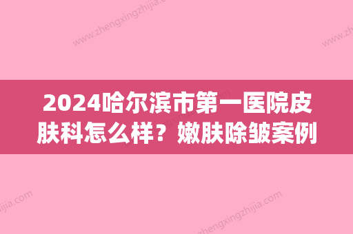 2024哈尔滨市第一医院皮肤科怎么样？嫩肤除皱案例及果图分享(哈尔滨二一一医院皮肤科专家出诊表)