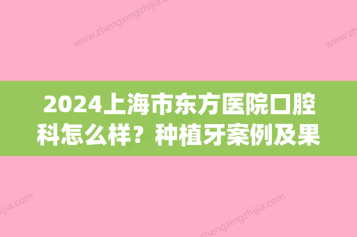 2024上海市东方医院口腔科怎么样？种植牙案例及果图公布(上海东方医院种植牙多少钱一颗?)