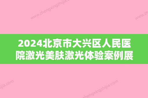 2024北京市大兴区人民医院激光美肤激光体验案例展示｜附前后体验果图