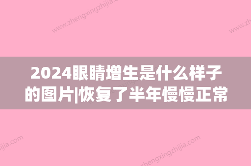 2024眼睛增生是什么样子的图片|恢复了半年慢慢正常~