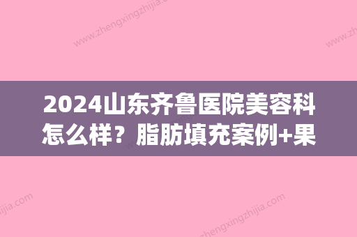 2024山东齐鲁医院美容科怎么样？脂肪填充案例+果图公布(济南面部脂肪填充)