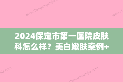 2024保定市第一医院皮肤科怎么样？美白嫩肤案例+果图公开(保定第一医院皮肤科好吗)