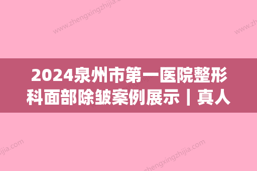 2024泉州市第一医院整形科面部除皱案例展示｜真人体验细节图公布(泉州第一医院美容整形科怎样)