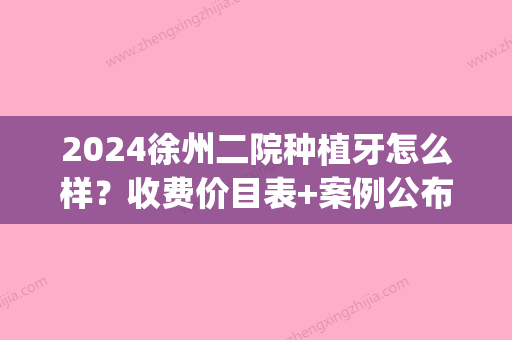 2024徐州二院种植牙怎么样？收费价目表+案例公布(徐州市口腔医院种植牙价格)