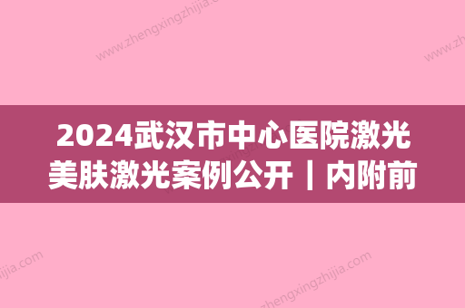 2024武汉市中心医院激光美肤激光案例公开｜内附前边变化果图(武汉市第一医院美容激光祛斑)