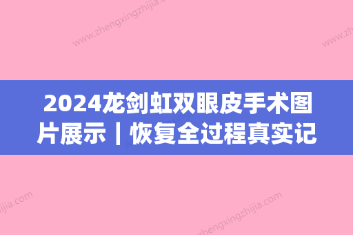 2024龙剑虹双眼皮手术图片展示｜恢复全过程真实记录(龙剑虹双眼皮价格)