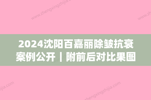 2024沈阳百嘉丽除皱抗衰案例公开｜附前后对比果图(沈阳百嘉丽双眼皮修复)