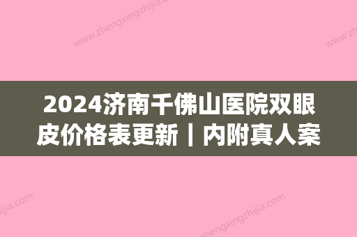 2024济南千佛山医院双眼皮价格表更新｜内附真人案例+果图(济南千佛山医院赵悦双眼皮怎么样)