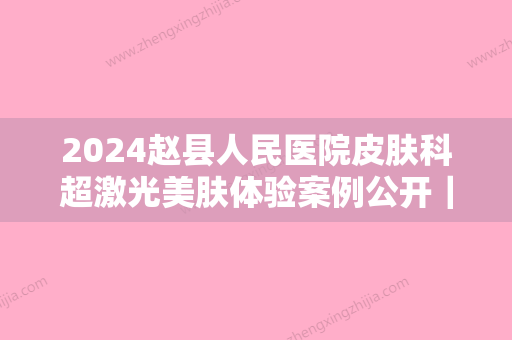 2024赵县人民医院皮肤科超激光美肤体验案例公开｜内附前后果图