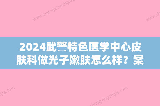 2024武警特色医学中心皮肤科做光子嫩肤怎么样？案例+果图分享