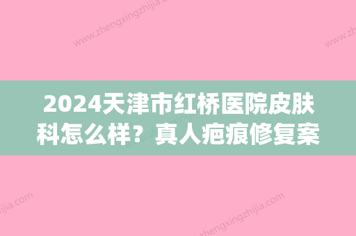 2024天津市红桥医院皮肤科怎么样？真人疤痕修复案例公开(天津市红桥医院有皮肤科吗)